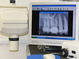 Leawood Family Dental - Digital X-Rays