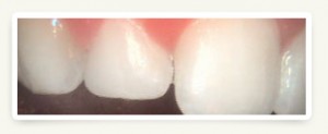 Leawood Family Dental - Cosmetic Dentistry