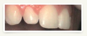 Leawood Family Dentistry - Cosmetic Dentistry